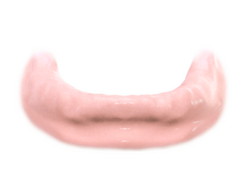 Implantes dentales. Clínica Dental Fernández León